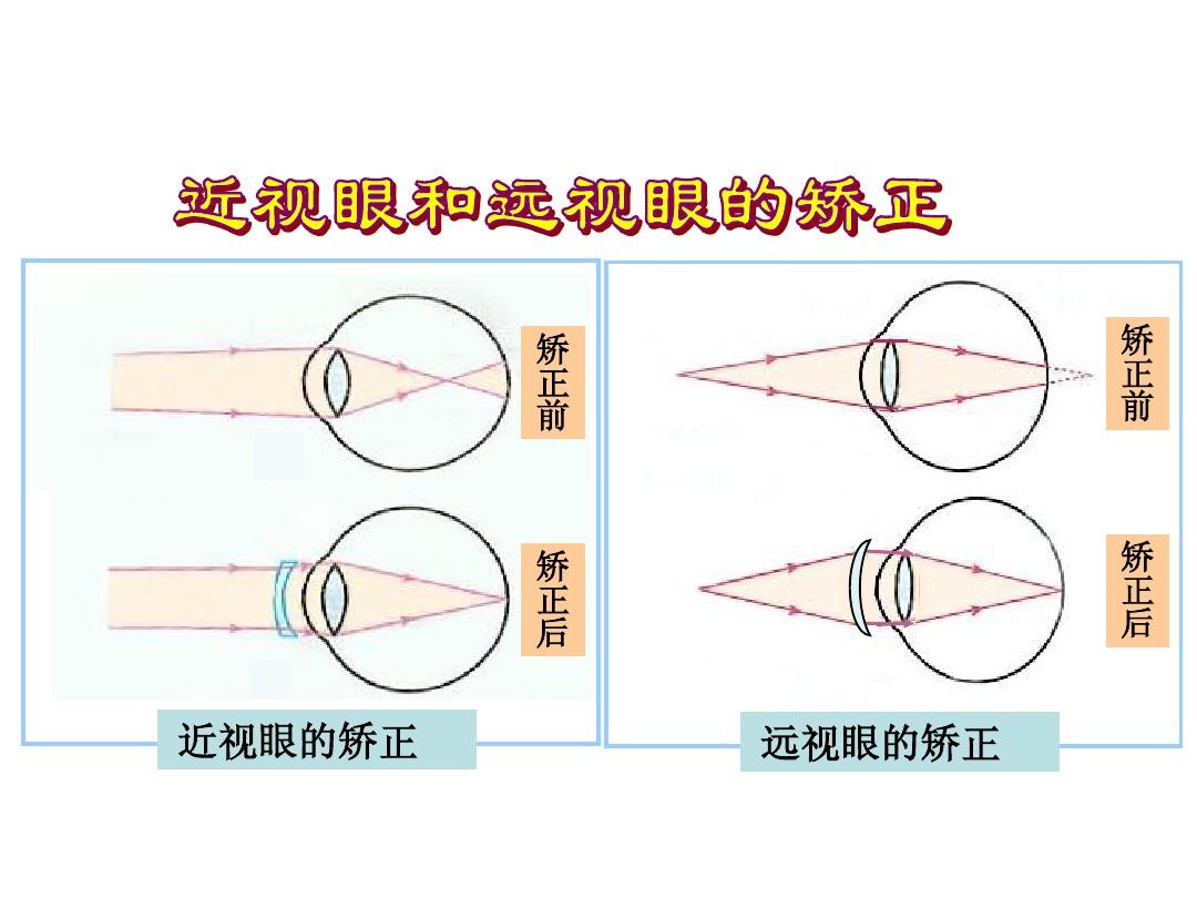 前視后視怎么區分-圖1